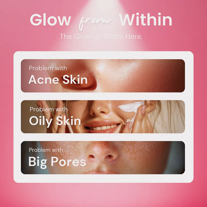 Froser™ Sonic Facial Cleansing Device for Deep Pore Cleaning